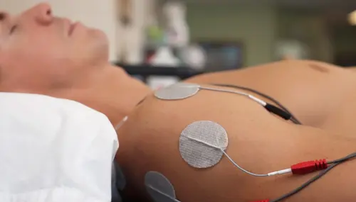 Electroterapia como TENS y Corrientes Interferenciales