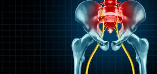 Neuropatía del nervio pudendo: Causas, síntomas y tratamientos