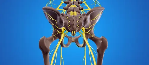 Neuropatía por atrapamiento del nervio pudendo