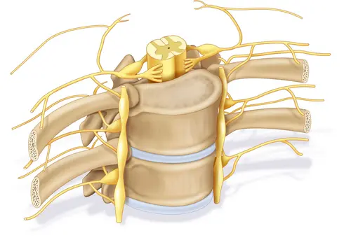 Neuropatía por compresión de raíces nerviosas en la columna vertebral