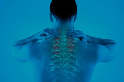 Radiculopatía cervical que irradia hacia el brazo