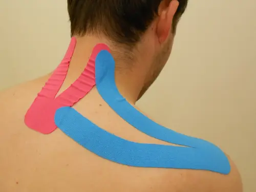 Terapia con vendajes neuromusculares o kinesiotaping