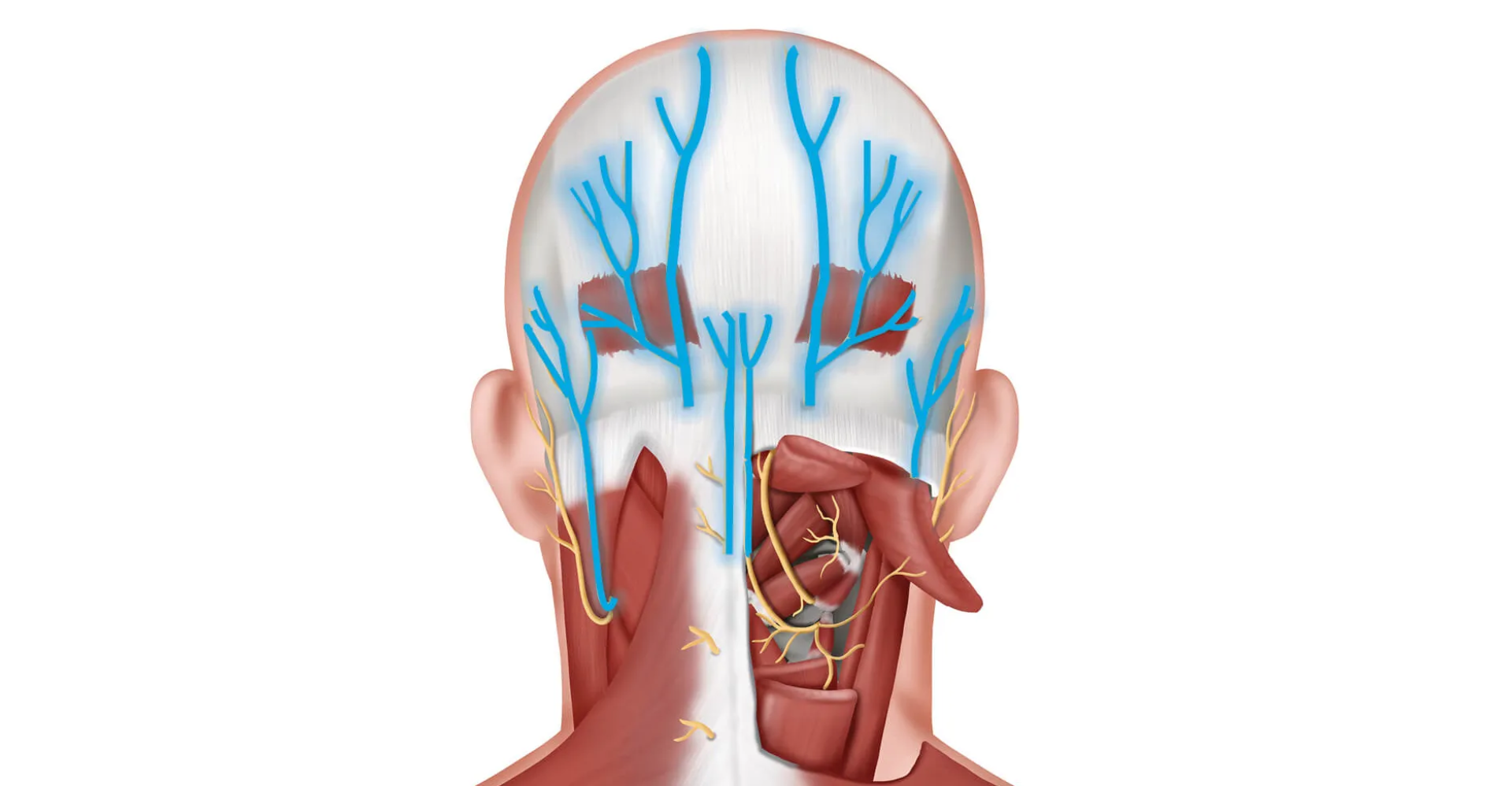 Entiende la Neuralgia del Nervio Alveolar Inferior