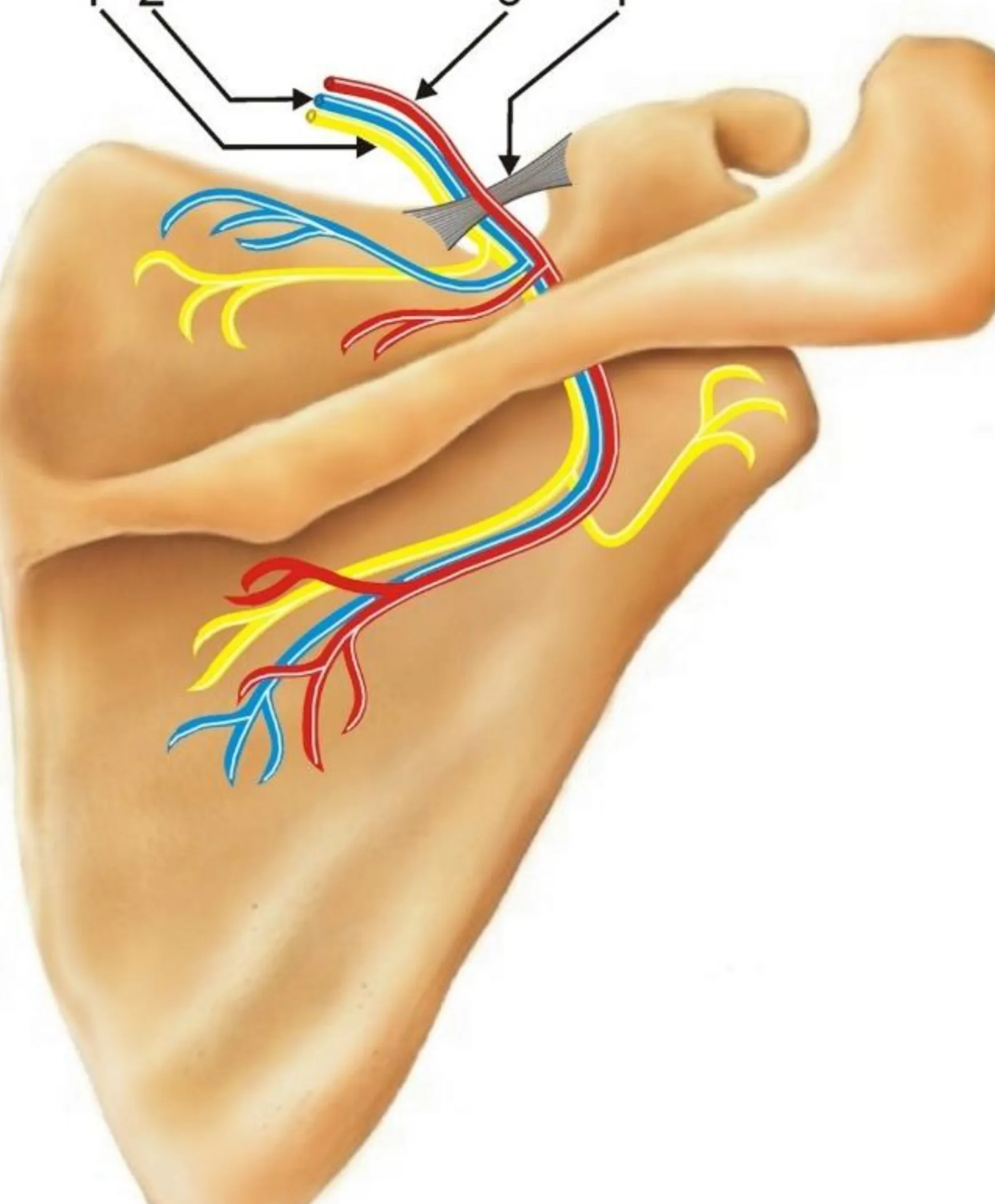 Neuralgia del nervio supraescapular