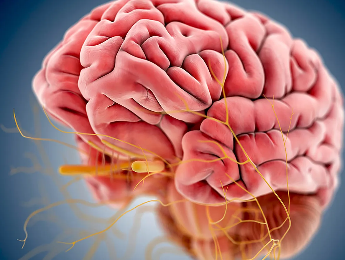 Comprendiendo la Neuropatía del Nervio Mandibular