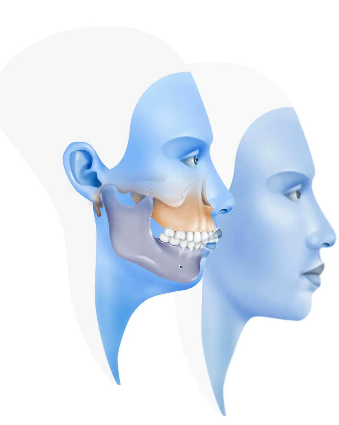 Soluciones para el Dolor Mandibular Postoperatorio