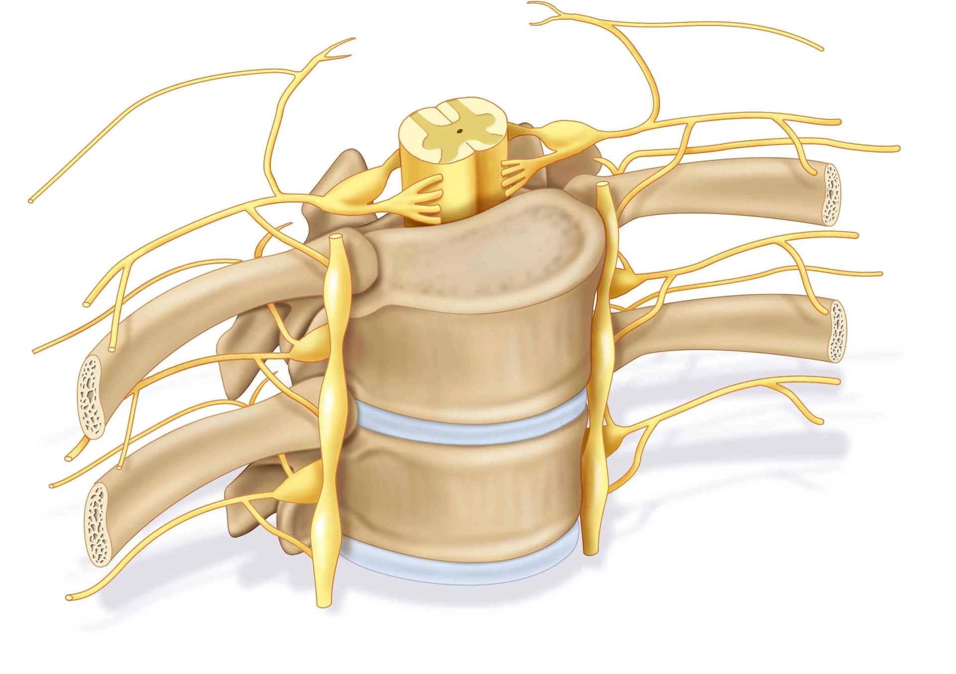 Neuropatía por compresión de raíces nerviosas en la columna vertebral