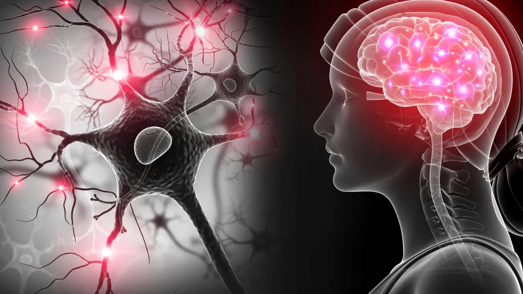 Neuropatía por esclerosis múltiple