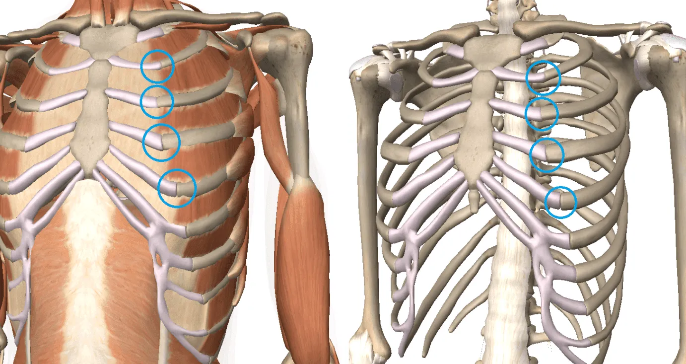 Tratamiento para la neuropatía derivada del Síndrome de Tietze