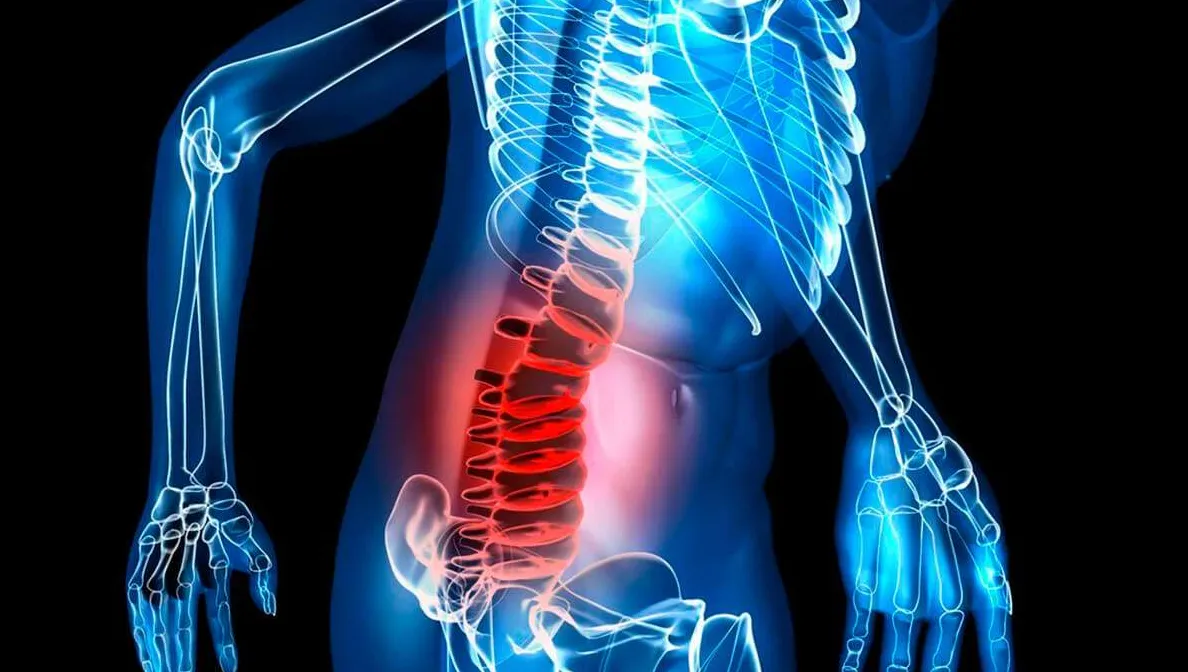 Identifica los Síntomas de la Neuropatía Postraumática en el Abdomen y la Zona Lumbar