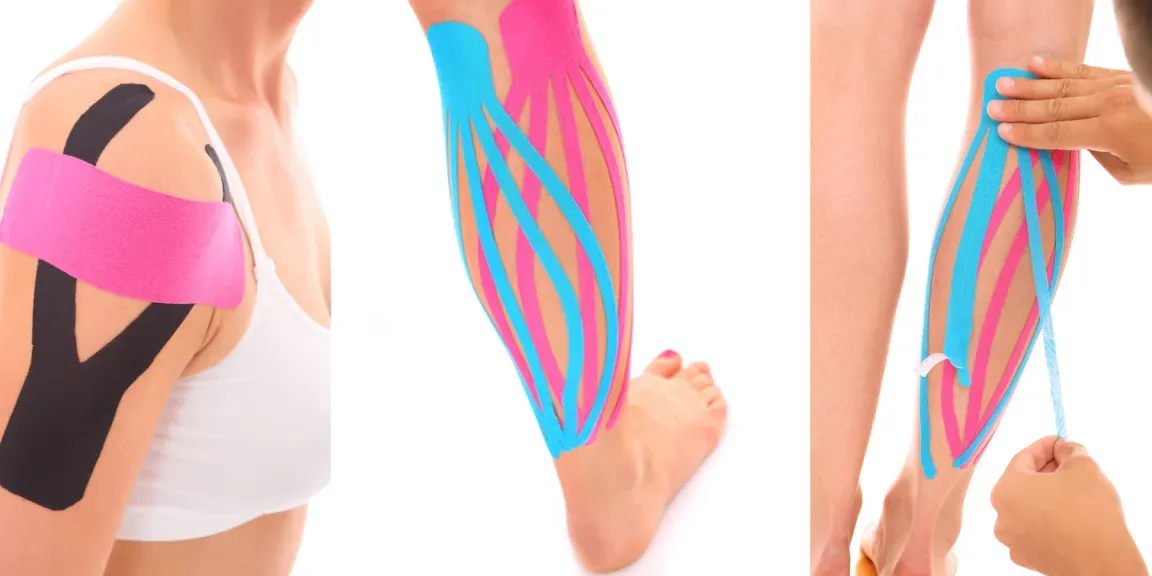 Terapia con vendajes neuromusculares o kinesiotaping